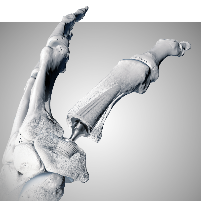 Solutions for surgeons